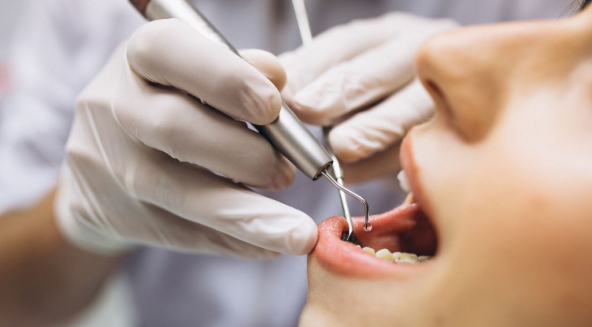 Periodontoloji (Diş Eti Hastalıkları) Nedir?